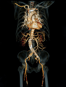 電磁波(X線)電磁波(X線)を使った腹部の3D画像